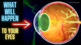 Why Staring At The Solar Eclipse Is Dangerous