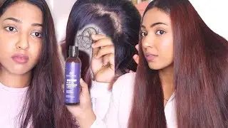 This oil stopped my chunks of Hairfall & healed my bald patches by giving Healthy Long Soft Hair