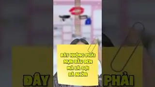 Đây không phải mụn đầu đen mà là sợi bã nhờn #chamsocda