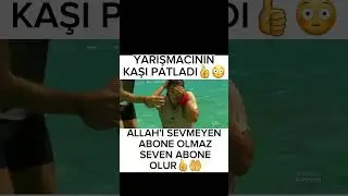 Yarışmacının Kaşı Patladı