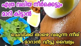 എത്ര വലിയ നീർക്കെട്ടും 1 ദിവസം കൊണ്ട് മാറി കിട്ടാൻ Neerkettu Maran / Inflammation Home remedies