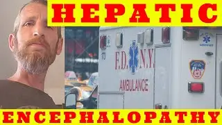 Hepatic Encephalopathy Hospital Visit - Liver Cirrhosis Vlog