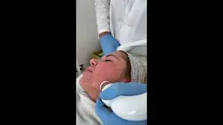 Lifting non chirurgico con ultrasuoni micro-focalizzati - cfu elife