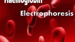 Lab: hemoglobin electrophoresis (Biochemistry)