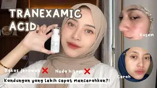 Tranexamic Acid Efektif untuk Mencerahkan Wajah? SKINTIFIC 3% TXA untuk Noda Hitam dan Kemerahan!✨