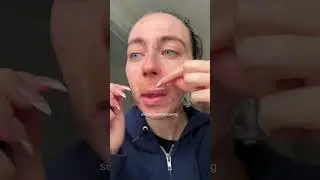 Pimple Patch subtle foreshadowing thats satisfying👀 