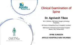 ORTHo - Dr. Agnivesh Tikoo - History and Examination of Spine.