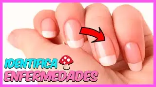 Señales Para Identificar ENFERMEDADES de las UÑAS ¿Se Pueden PREVENIR? - Curso De Uñas #002