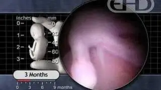 3 Months Pregnant: End of the first trimester