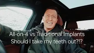 Full Arch Dental Implants vs Traditional Implants : Pros and Cons