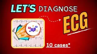 ECG Cases | 10 Cases explained 📑 | LET'S DIAGNOSE ECG - Series