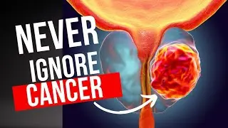 The Shocking Truth About Black Men And Prostate Cancer