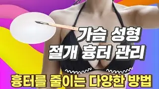 가슴성형 절개흉줄이기 영상