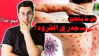 هل جدري القرود قاتل ؟ | أنواع جدري القرود | هل جدري القرود معدي | كل ما تريد معرفته هنا 😱➡️
