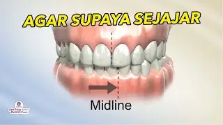 RAHANG MIRING BISA DILURUSIN?