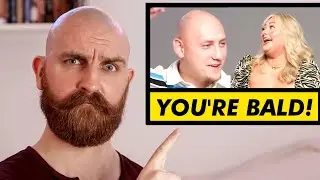 Are BALD Men Attractive? | HONEST ANALYSIS