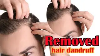 how to removed hair dandruff in photoshop 2023 