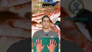 சதைசுருக்க வியாதி என்றால் என்ன|Scleroderma causes|Systemic sclerosis|Autoimmune disease #scleroderma