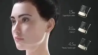 Аппарат 12 D MaX принцип работы манипул