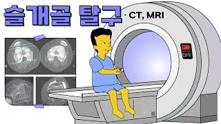 슬개골 탈구10 - CT, MRI 영상