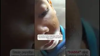 Lagian ulat suka makan daun 🌱 bukan makan gigi yang berlubang