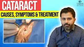 What is Cataract: Causes , Symptoms & Treatment | Best Treatment For Cataract | Best Lens