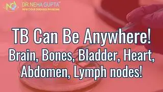 Tuberculosis I Symptoms I Signs I Tests #drnehagupta #TB # TestsforTB #InfectiousDiseases #cureforTB