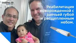 Реабилитация новорожденных с заячьей губой и расщепленным небом | Shining3D