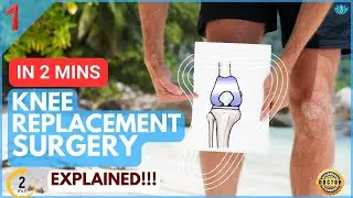 Knee Replacement surgery | Explained in 2 minutes!!!