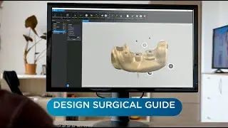 Who is Implant 3D software?