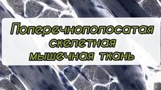 #Поперечнополосатая