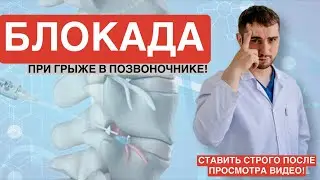 НЕ СОГЛАШАЙТЕСЬ НА БЛОКАДУ ПРИ ГРЫЖЕ В ПОЗВОНОЧНИКЕ, ПОКА НЕ ПОСМОТРИТЕ ЭТО ВИДЕО!