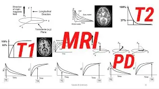 MRI Contrast Mechanisms T1 T2 PD Weighing
