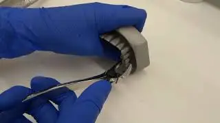 Dental forceps movement posteriors