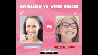 Is Invisalign Less Painful Than Metal Braces?
