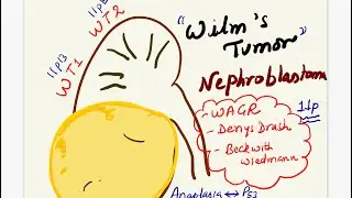 Wilm’s tumor Robbins 10th ed important ✅theory✅practical✅mcqs # neetpg #inicet #next