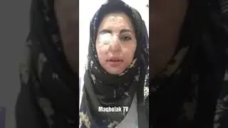 اگر افغان هستی و غیرت داری فقط یک بار به حرفایه این خواهر افغانم گوش کنید😢شماره تماس با نفیسه جان 0