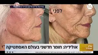 ד