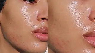 SKIN THERAPY.