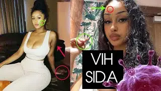 Bimwe mu bimenyetso byakwereka ko ufite virusi itera sida