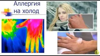 Аллергия на холод Аюрведические асаны перед выходом на мороз