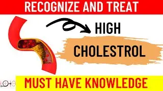 Struggling with High Cholesterol? Learn How to Manage Cholesterol Levels Effectively!