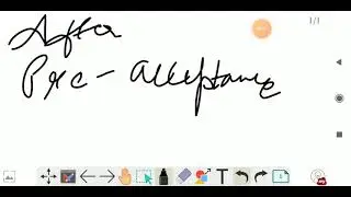 UNIVERSITALY PORTAL | WHAT TO DO AFTER RECEIVING PRE-ACCEPTANCE LETTER? | DOV | QnA |