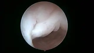 VID001