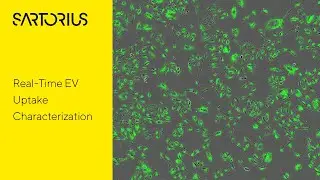 Real Time EV Uptake Characterization Using an Incucyte®️ Live Cell Imaging System