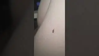 комар пьет кровь смотреть видео жёстокое