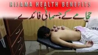 Hijama Health benefits VLOG 04