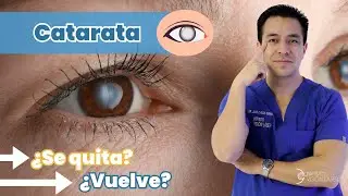 Catarata ¿se quita? ¿vuelve?