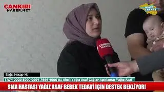 YAĞIZ ASAF TEDAVİSİ İÇİN DESTEK BEKLİYOR