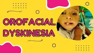 Orofacial Dyskenisia in a Child | Clinical Sign Video